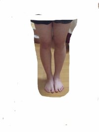 中学生です 生足ショートパンツのコーデをしたいのですがこの脚は見 Yahoo 知恵袋