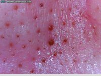 宇津木先生の本を読んでから挫折もしつつ３年程 肌断食のようなノンスキンケアを実 Yahoo 知恵袋