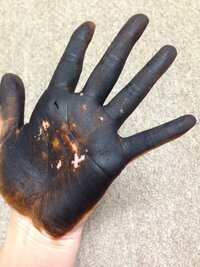 黒染めしたんですが 手袋をつけなかったため 手が真っ黒です 爪も 落 Yahoo 知恵袋