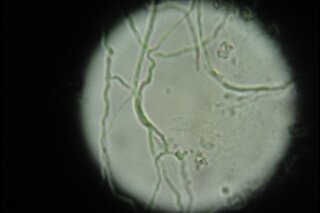 Yahoo!知恵袋爪白癬が疑われる患者さんのKOH直接鏡検像です。これは糸状菌でしょうか?カンジダとの明らかな違いは、何かありますか?