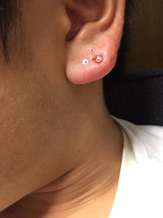 ハチ ダーツ ログ ピアス 二 連 位置 Terravivabio Org