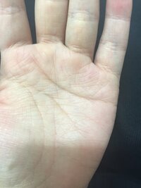 手相が詳しい方教えてください 最近薬指と小指の間にバッテンのような線がでて Yahoo 知恵袋