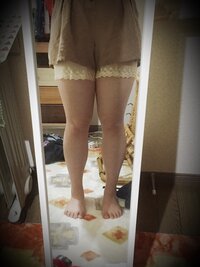 写真有 この足でショートパンツ スカートは醜いですか 質問です 画像の通 Yahoo 知恵袋