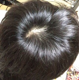 ここ数ヶ月で髪の毛がすごく薄くなりました - 髪が細くなり ...