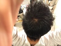 これってハゲですか つむじがでかいだけ まったくもって問題ないです Yahoo 知恵袋