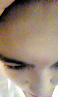 眉毛のあいだの部分が昨日くらいから腫れて痛いですなんでしょうか 詳しく Yahoo 知恵袋