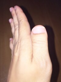 私の爪は幅広ですこの爪を矯正又は整形できるでしょうか 変わった爪してるね Yahoo 知恵袋