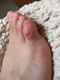 バレエの質問です 中２です 皆さん ポアントをはいていると足の皮が Yahoo 知恵袋