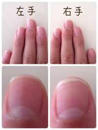 よく見えないですが右手の人差指と小指だけ女爪です キューテ Yahoo 知恵袋