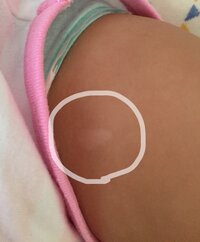 六ヶ月の赤ちゃんについてお腹と背中に白い斑点のようなシミ がありま Yahoo 知恵袋