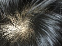 つむじ付近なんですが この赤い点はなんなのでしょうか 最近髪の毛が細くなっ Yahoo 知恵袋