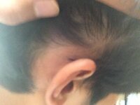 歳男です 耳の上から襟足にかけて髪が薄いような気がします これははげて Yahoo 知恵袋