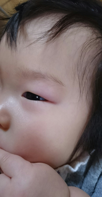 ９ヶ月荷なる娘が片目だけウインクします これぐらいになるとするようにな Yahoo 知恵袋