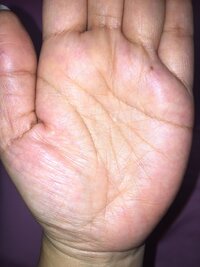 右手中指の仏眼 右手中指付け根に仏眼があります 中指でも仏眼なんで Yahoo 知恵袋