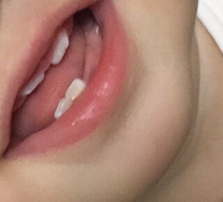 赤ちゃん 10ヶ月 が 物凄くすきっ歯で歯が斜めにはえていま Yahoo 知恵袋
