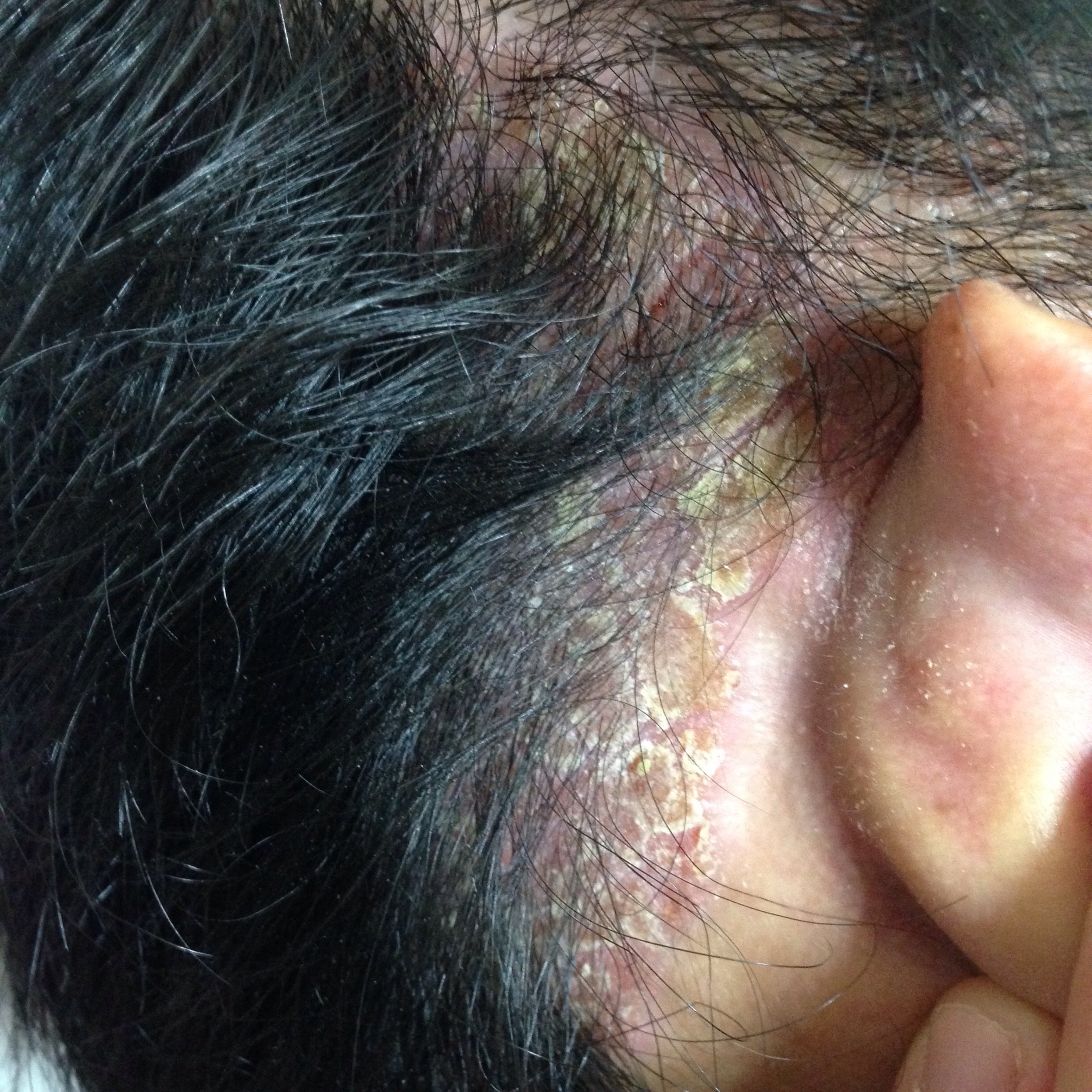 薄毛 抜け毛 すべての質問 Yahoo 知恵袋