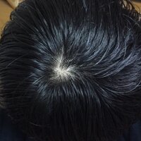 若ハゲ 画像を見ればわかるんですが 不自然な意味につむじがあり Yahoo 知恵袋