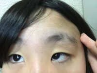 今年一年生になった娘の眉毛がはげています 娘の両方の眉毛に ６ Yahoo 知恵袋