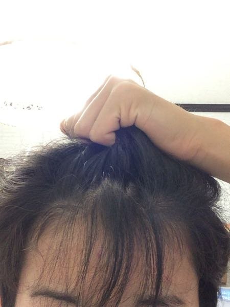 おかしいです 前髪 薄い 高校生