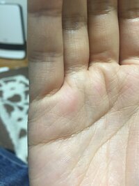 涙腺について質問します よく 涙腺が弱い涙腺がゆるいなどいますがどちらが正しい Yahoo 知恵袋