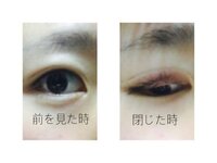 アイプチ利用者です 1番上の画像のような目が理想なのですが 伏し目と閉じた Yahoo 知恵袋