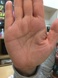 太陽環なのでしょうか はじめまして 最近手相に興味を持ちはじめてので 少 Yahoo 知恵袋