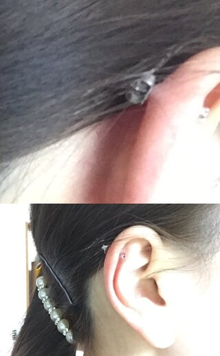 １時間ほど前軟骨にピアッサーで自分でピアスを開けました これは Yahoo 知恵袋