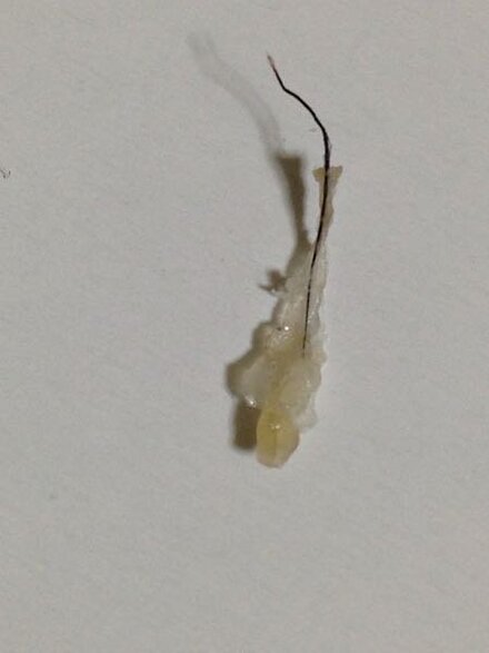 私はアイドル なのに こんな大きい鼻くそが出ちゃった 教えて しごとの先生 Yahoo しごとカタログ