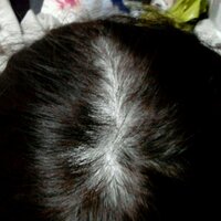 最近気づいたんですが 頭頂部から後頭部当たりまでの分け目がハゲて Yahoo 知恵袋