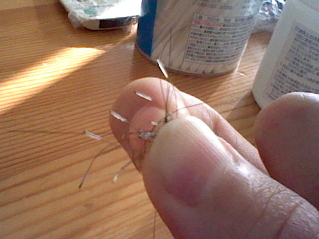 抜け毛 毛根 白い