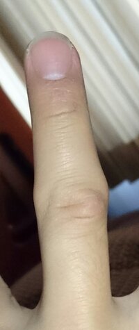 妊娠３３週の妊婦です ２８週頃から 手のむくみが気になりだしまし Yahoo 知恵袋