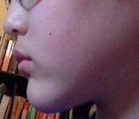 顎がすごいしゃくれています 歯を見せて笑うとすごく目立ちます 私の考 Yahoo 知恵袋