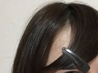 前髪に隙間ができるようになった はげですか 15歳です 前に Yahoo 知恵袋
