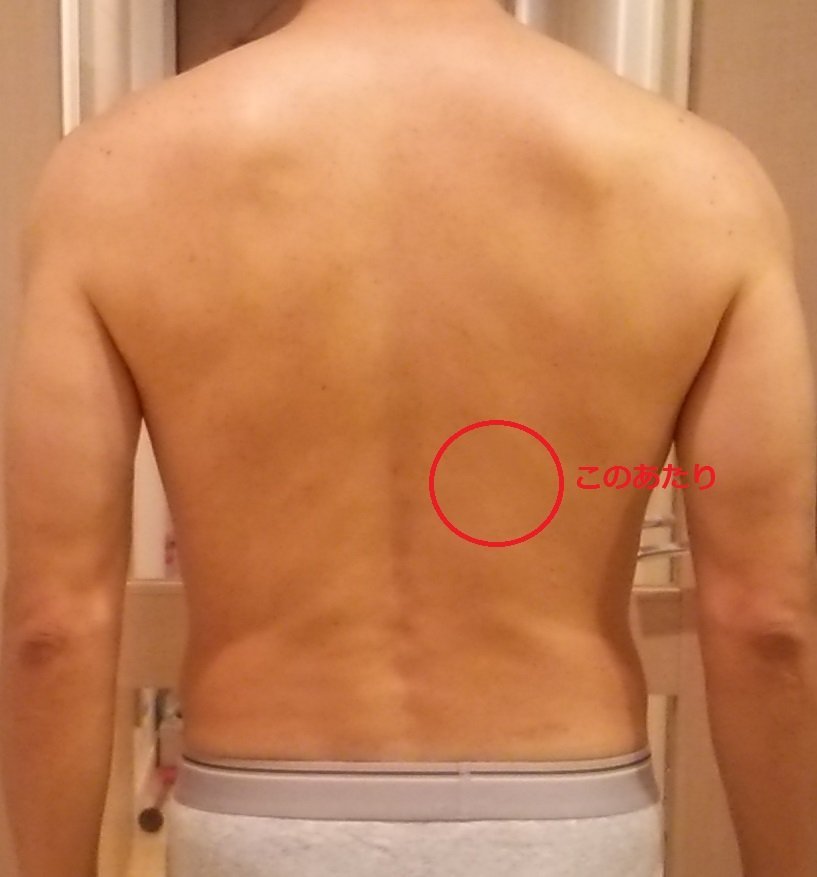 背中 の 痛み 右側 肩 甲骨 の 下