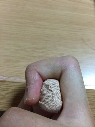 臭い ギプス
