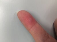 指から黒い線が出てきます 昨日洗濯物を畳んでいる最中に 何か Yahoo 知恵袋