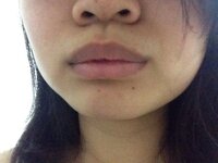 鼻下の脱毛について 女なのに青髭 色素沈着 があり コンプレック Yahoo 知恵袋