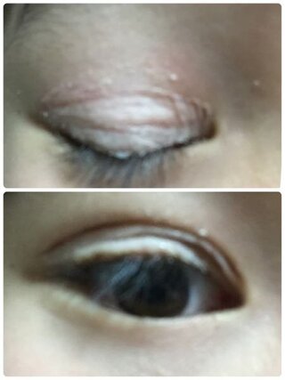 ローヤルプチアイムsを使い始めて 2日目なんですが なぜか 右目だけ Yahoo 知恵袋