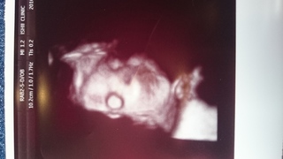 妊娠33週 ９ヶ月 です 先週の健診で撮ってもらった3dエコーの赤ちゃんの Yahoo 知恵袋