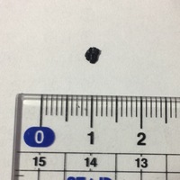 ベッドの黒いカスのようなものがよくついているのですが 何だと思いますか Yahoo 知恵袋