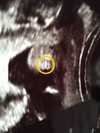 今妊娠5ヶ月の2週目です 今日のエコーで多分女の子だよと言われました Yahoo 知恵袋