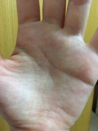 両手の運命線の様な線の上にばつ印があります これは悪いものだと聞き 心配に Yahoo 知恵袋