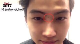 70以上 眉間 赤い 眉間 赤いあざ