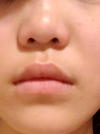 私の鼻は団子鼻 コイン100枚 今中学生で 切実に悩んでいます 私は鼻 Yahoo 知恵袋