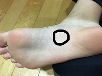 今日の夕方頃から 足の土踏まずのかかと寄りの場所 ちょうど写真の あたりが Yahoo 知恵袋