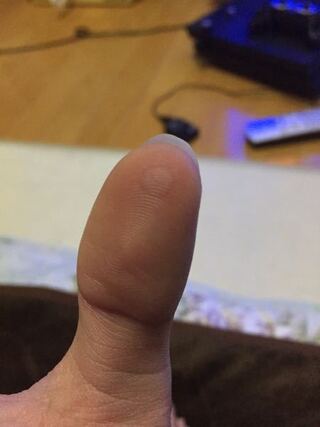 親指のトゲが抜けません 5円玉もやりました 梅干しや ネギのエキスな Yahoo 知恵袋