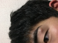 4週間前ほどから 眉毛の外側の下2ミリほどのところに しこりができました Yahoo 知恵袋