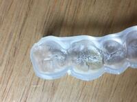 マウスピースに黄色と白色の汚れみたいなものが付いているのですが Yahoo 知恵袋