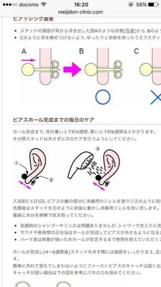 ピアスを開けた後についてです 開けてから 消毒ジェルなどつけてケアす Yahoo 知恵袋