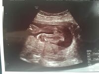 妊娠22週のエコーです 性別判定お願いします 男の子に見え Yahoo 知恵袋